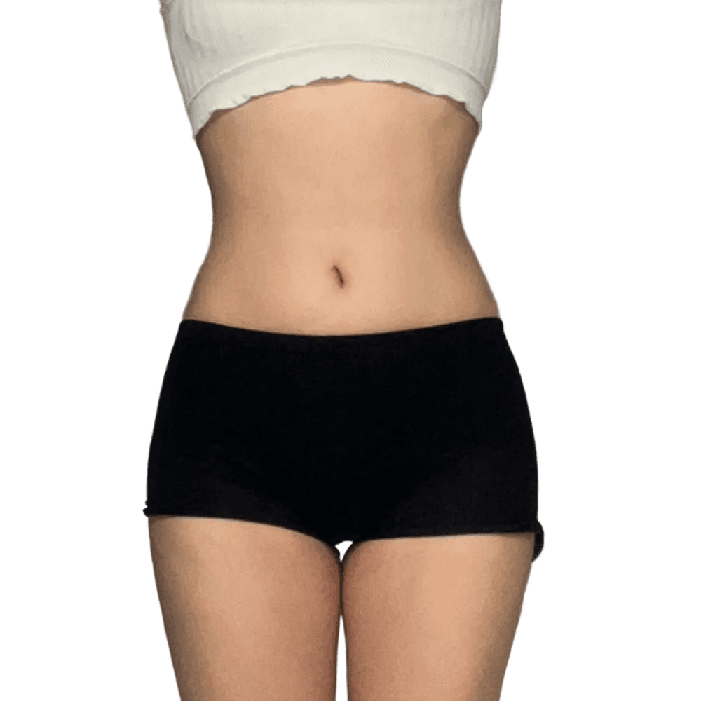 복부 수술 전 사진 1