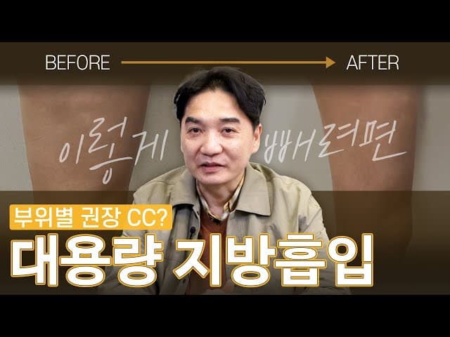 대용량 지방흡입은 몇 CC까지 가능할까?