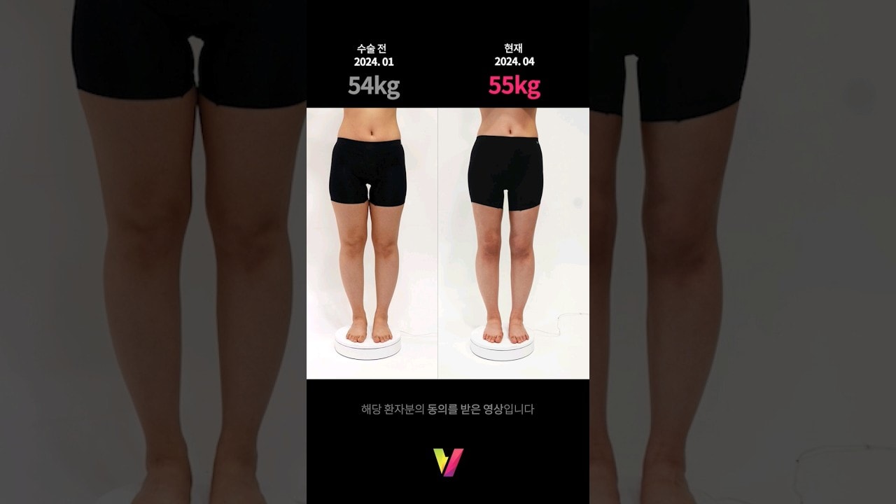 몸무게가 중요하지 않은 이유 #눈바디 (허엉무/샤넬/러브핸들/힙윗라인)
