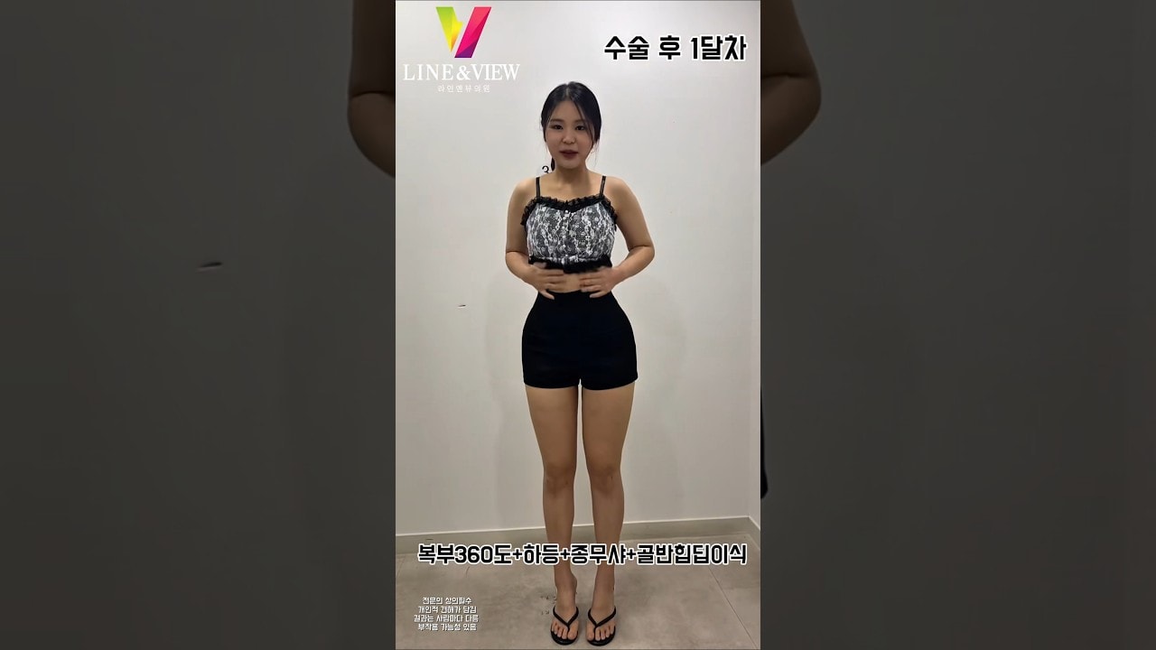 허리는 잘록하게 ⏳골반은 볼륨 있게 🍑종아리는 슬림하게 🩰1개월차, 완성된 몸매 ✨   #라인앤뷰 #복부지흡 #골반지방이식 #종아리지흡 #완선된몸매 #완벽라인 #shorts
