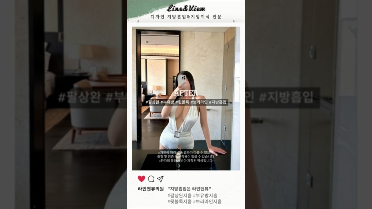 너무,,옙흐자나,,,♥ 팔상완지방흡입 | 부유방지방흡입 | 뒷볼록지방흡입 | 브라라인지방흡입 리얼 전후 #shorts #지방흡입 #지방흡입후기 #몸매