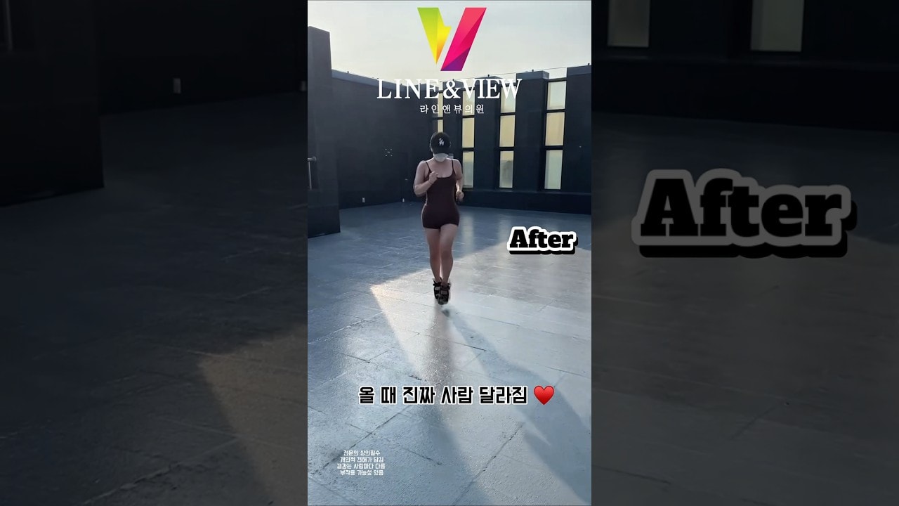 같은 사람 맞아 ⁉️갈 때랑 올 때가 너무 다르면 반칙이지 😳반칙 아니고 기적이라고 …라인앤뷰 기적 🪄 #라인앤뷰 #복부지흡 #지흡잘하는곳