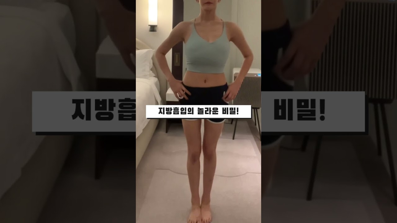 다이어트만으로 뱃살 빼려고요? 이것 안 하면 복부 지방은 절대 안 빠집니다.복부 지방흡입 후 단 한달 만에 허리 둘레 15cm 감소?!#지방흡입 #대용량지방흡입후기 #복부지흡