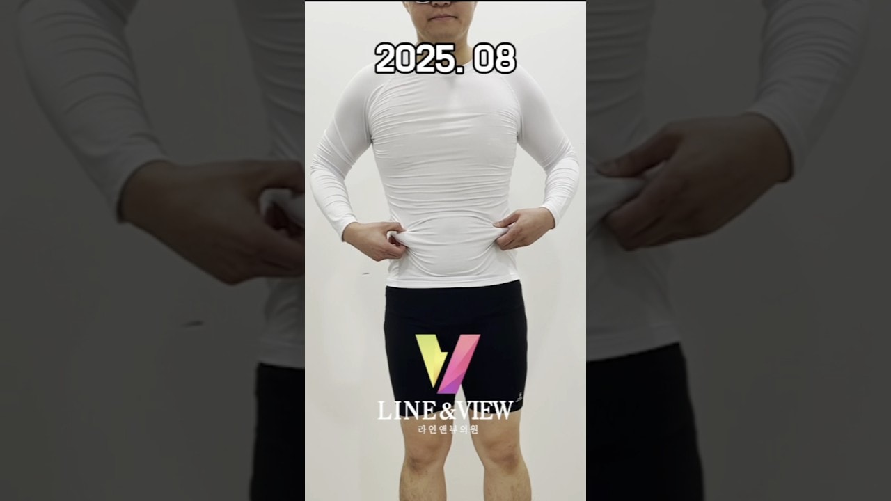남성분들 아무리 운동해도 안되는여유증 복부 때문에고민 많으셔쬬잉...?! 5월달에 라인앤뷰 만나고 달리기가 너무 편해지셨다는우리 고갱님 각잡힌바디라인실화소니...?!!