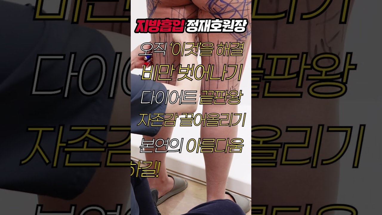 고도비만 탈출 성공..!