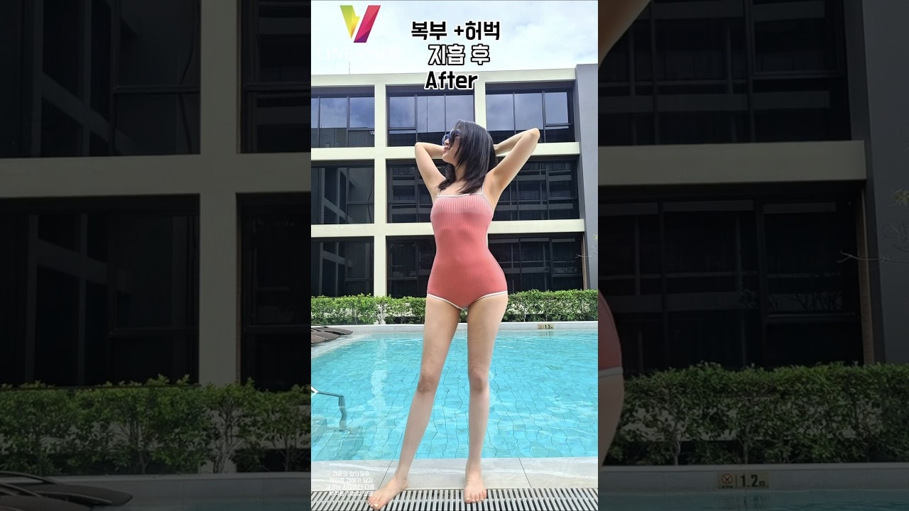 시원한 허리선 + 늘씬한 허벅지 키까지 커 보이는 기적 같은 효과를 우리가 해냅니다 💪🏻여러분도 인생을 지흡 전과 후로 나누어 보세요 💕#라인앤뷰 #지방흡입 #복부지흡 #허벅지지흡
