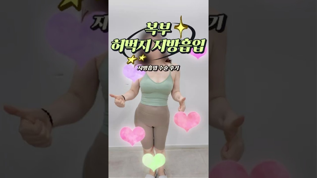 복부 및 허벅지 지방흡입 수술 후기!!!!