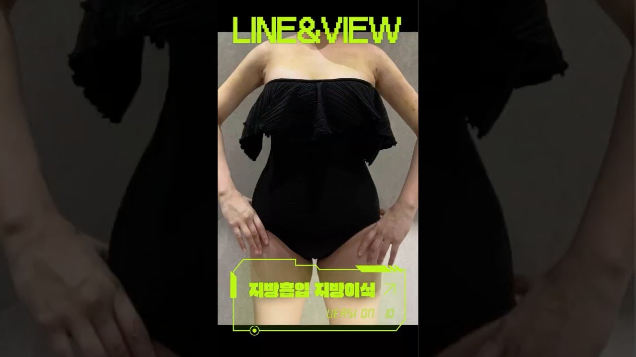 곧 다가올 여름 라인앤뷰의원과 함께해요 #지방흡입 #지방이식