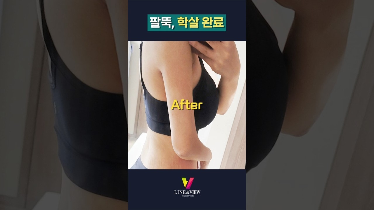 언제까지 오버핏만 입을거야? #shorts