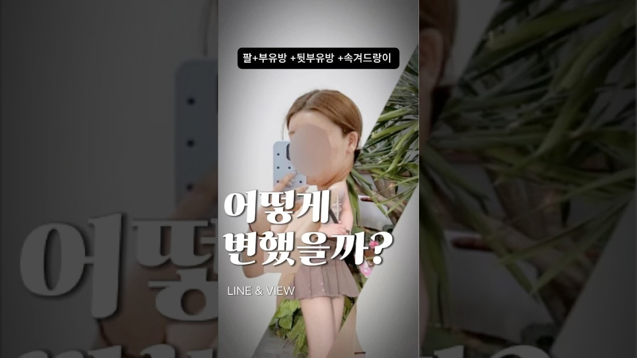 과연 저는 어떻게 변했을까요? #체형변화 #다이어트 #체형관리 #지방흡입 #자기관리