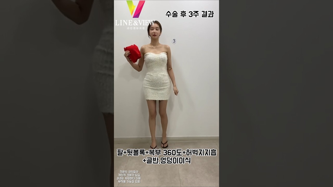 3weeks = New me 💕결심 후 딱 3주, 거울 속 새로운 나와 마주하는 중 ➤멍과 붓기 대신, 자신감이 채워지고 있어요 𓆩🖤𓆪#복부지흡 #지흡잘하는곳 #골반이식 #라인앤뷰