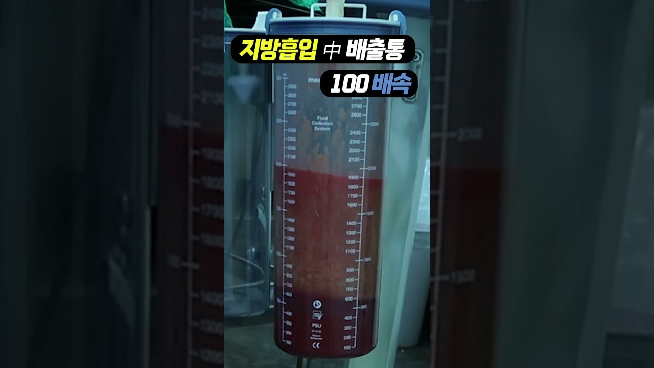 비만 기다려 이제 시작이다