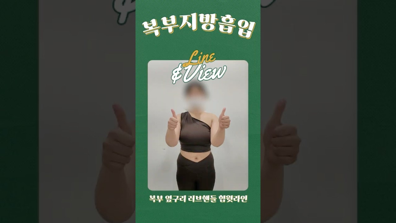 복부 지방흡입 변화!! 지방흡입 단순히 빼는 수술이 아닌 라인과 비율을 만드는 수술입니다🩷