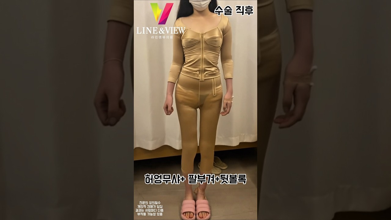 수술 직후 모습 →붓기 있을 줄 알았는데 →이미 뼈말라라인💕벌써 기대되는 결과를라인앤뷰에서 만나보세요 👏🏻#라인앤뷰 #허벅지지방흡입 #팔지방흡입 #뼈말라라인 #뼈말라 #shorts