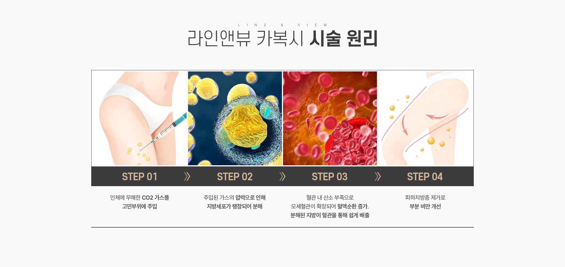 카복시 시술원리
